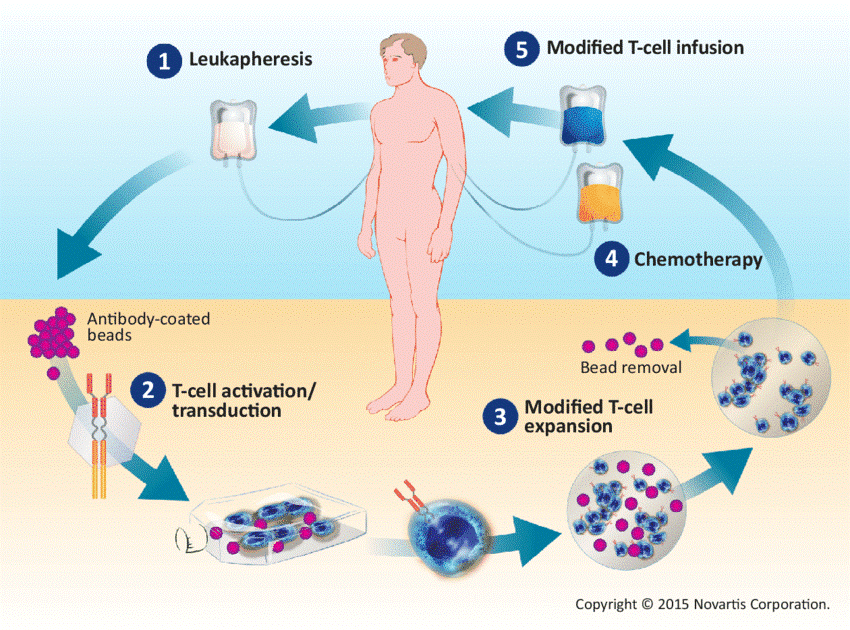 تکنولوژیCAR T cell